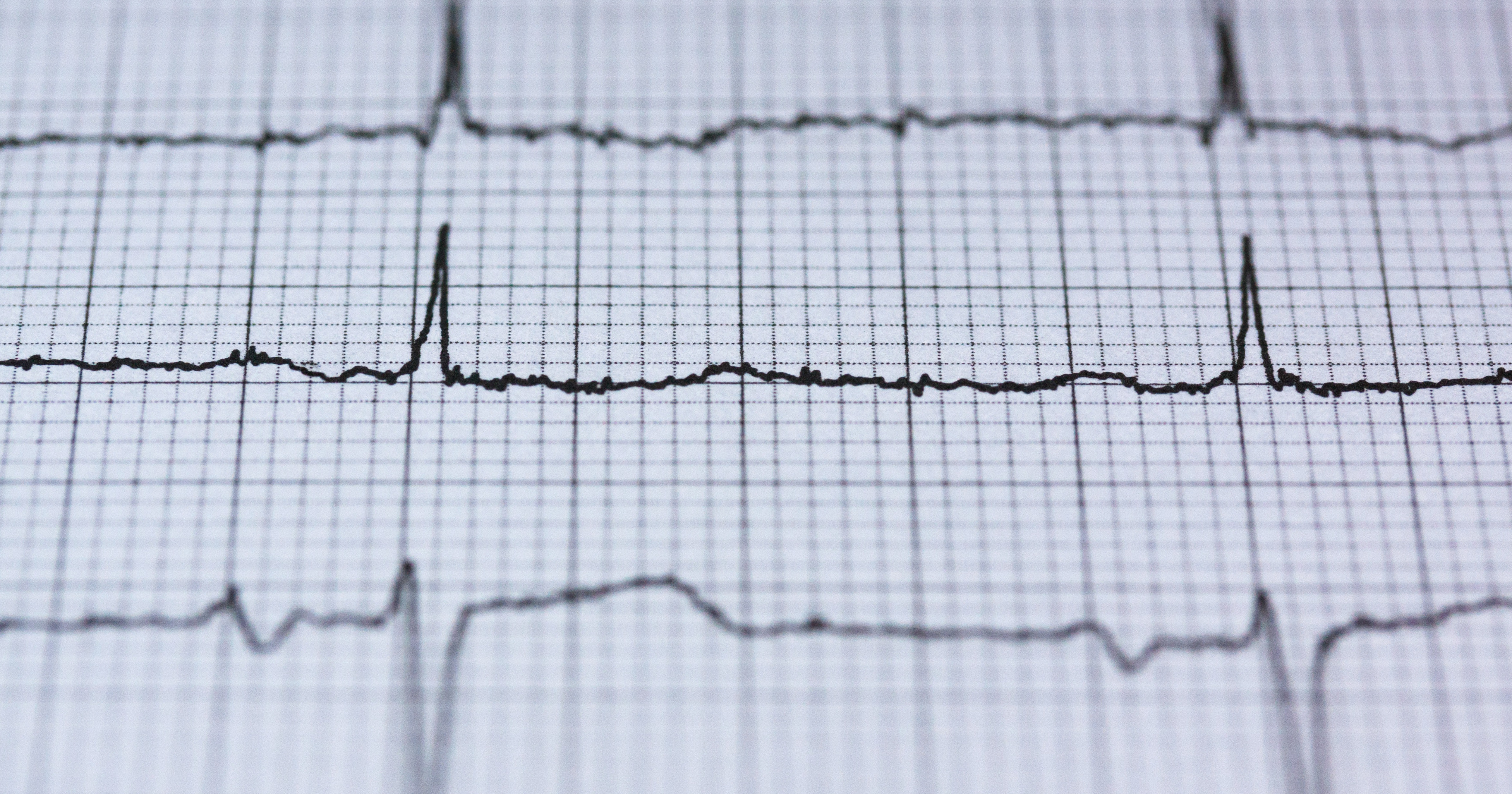 heart-scanner banner